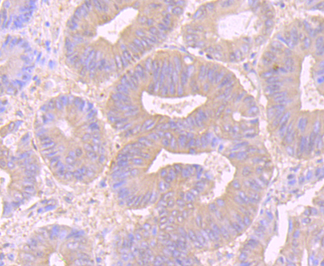 Desmoglein 2 Rabbit mAb