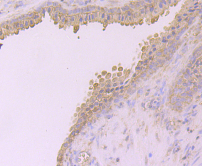 Desmoglein 2 Rabbit mAb