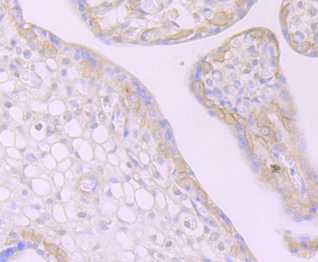 Desmoglein 2 Rabbit mAb