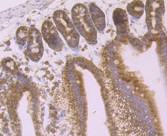 Desmoglein 2 Rabbit mAb