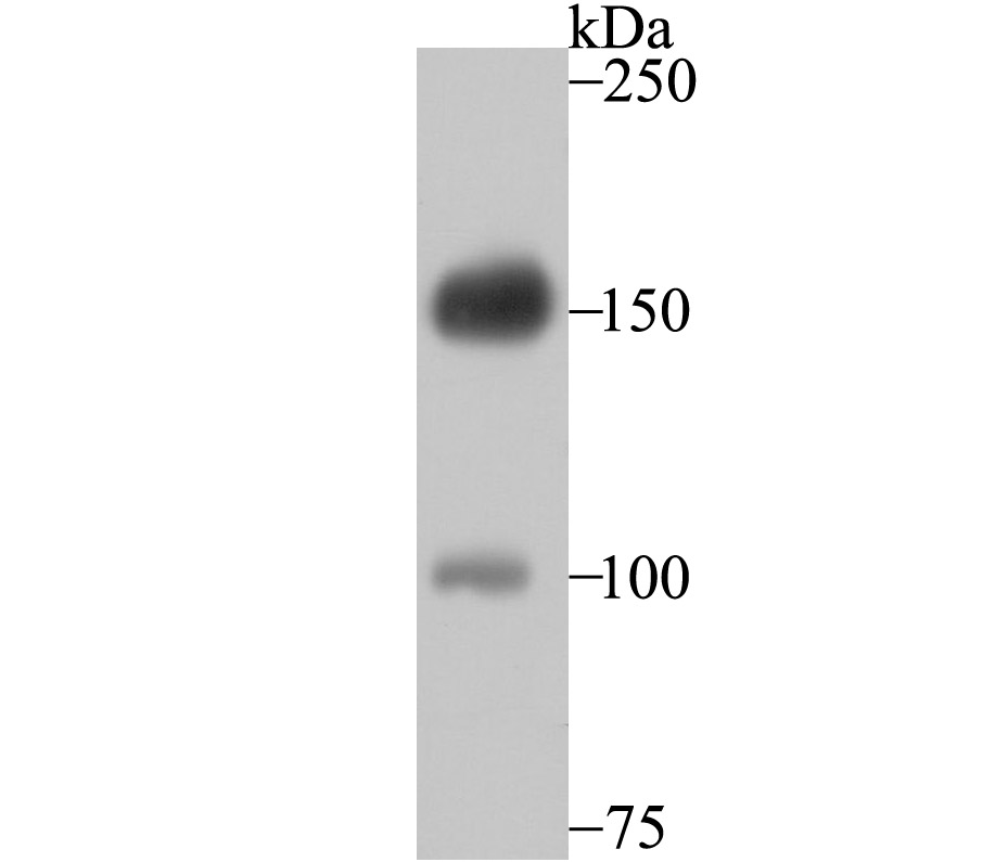 Desmoglein 2 Rabbit mAb