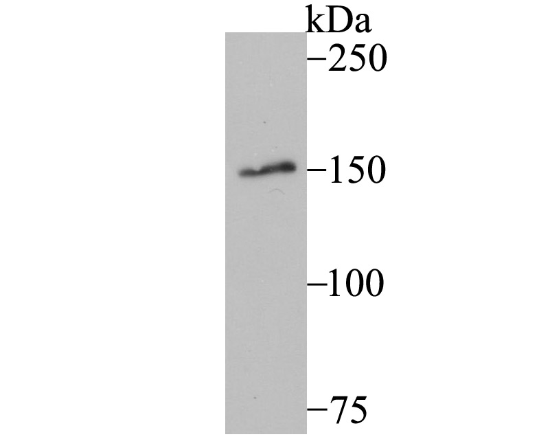 MYBBP1A Rabbit mAb