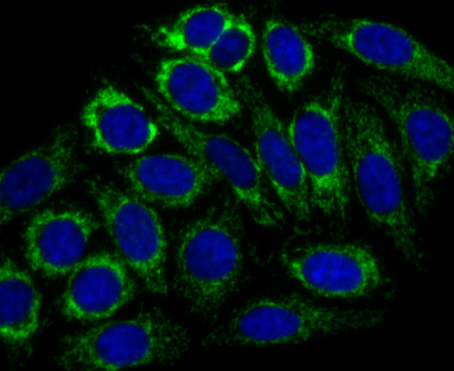 CPS1 Rabbit mAb