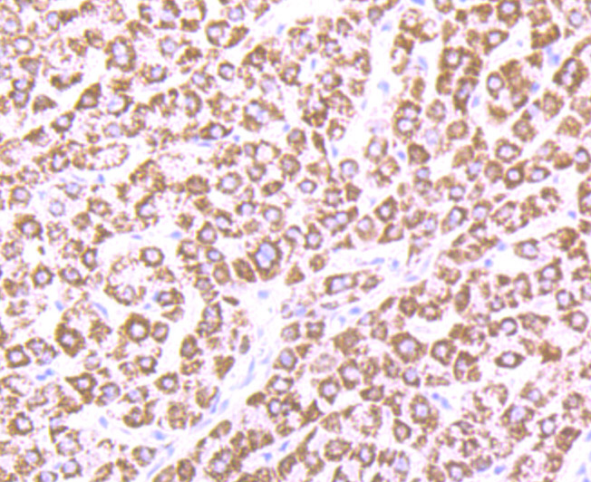 CPS1 Rabbit mAb