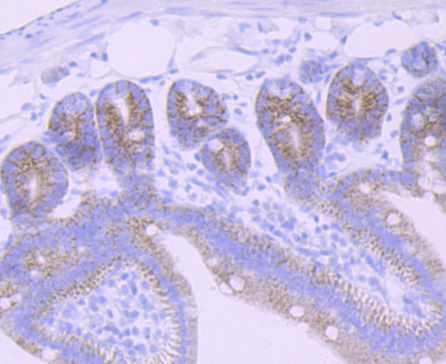 CPS1 Rabbit mAb