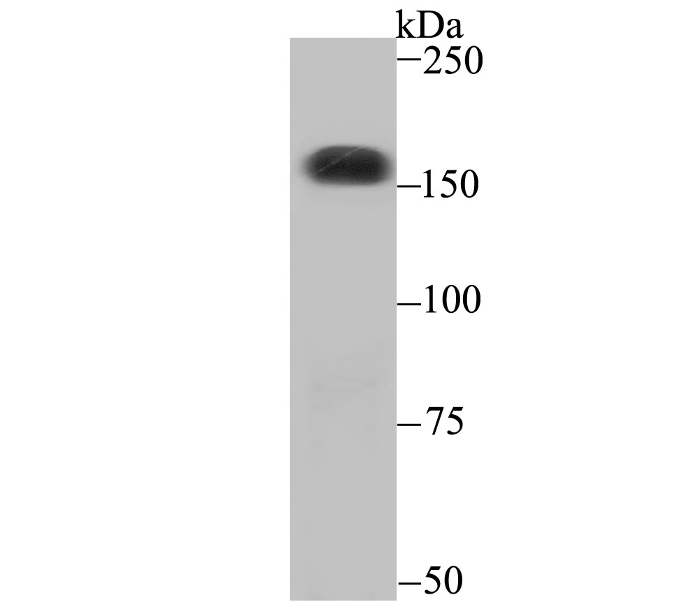 CPS1 Rabbit mAb