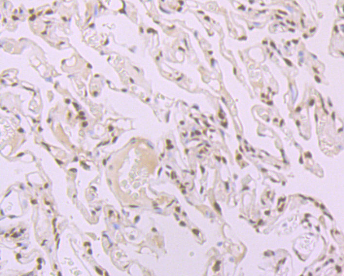 SF2 Rabbit mAb