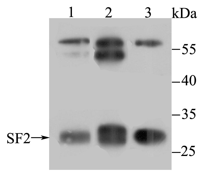 SF2 Rabbit mAb