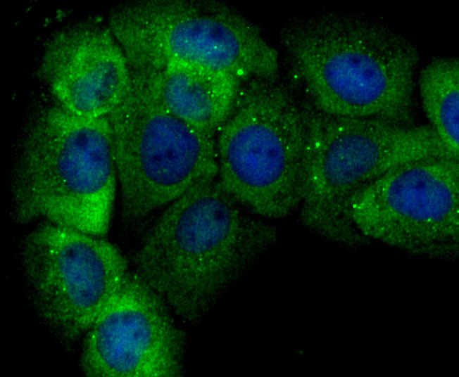 GST3 Rabbit mAb