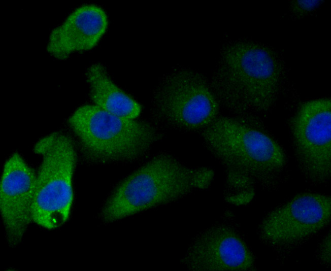 GST3 Rabbit mAb