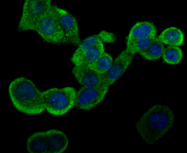 GST3 Rabbit mAb