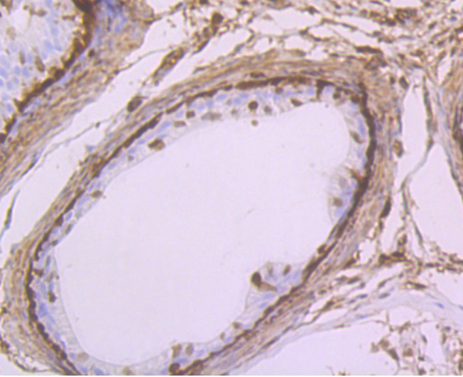 GST3 Rabbit mAb