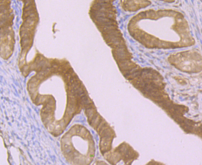 GST3 Rabbit mAb