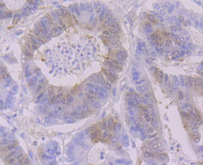 RRM1 Rabbit mAb