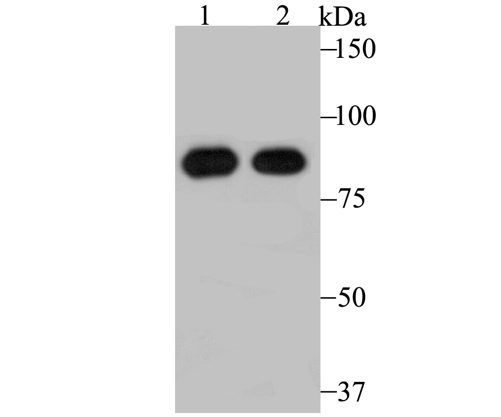 RRM1 Rabbit mAb