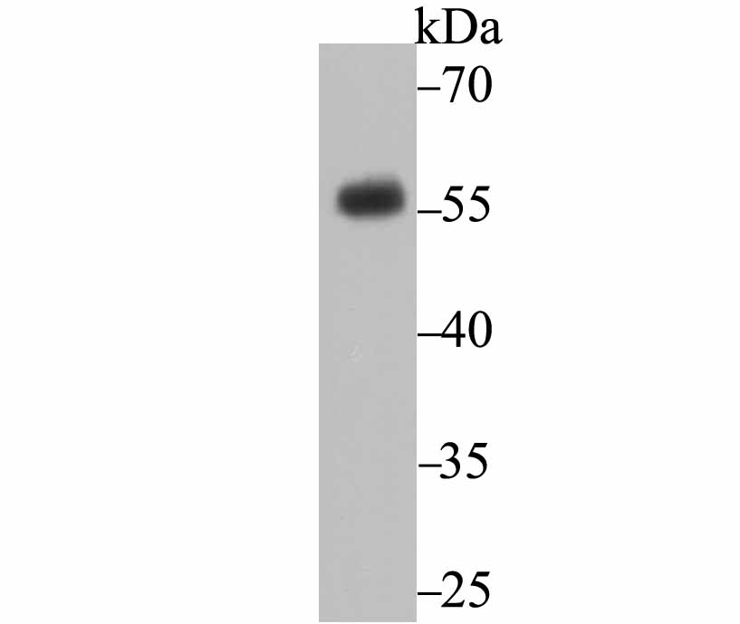 CD27 Rabbit mAb