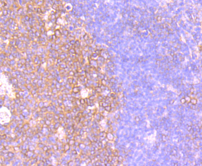 CXCR5 Rabbit mAb