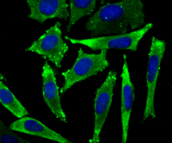 eEF1A1 Rabbit mAb