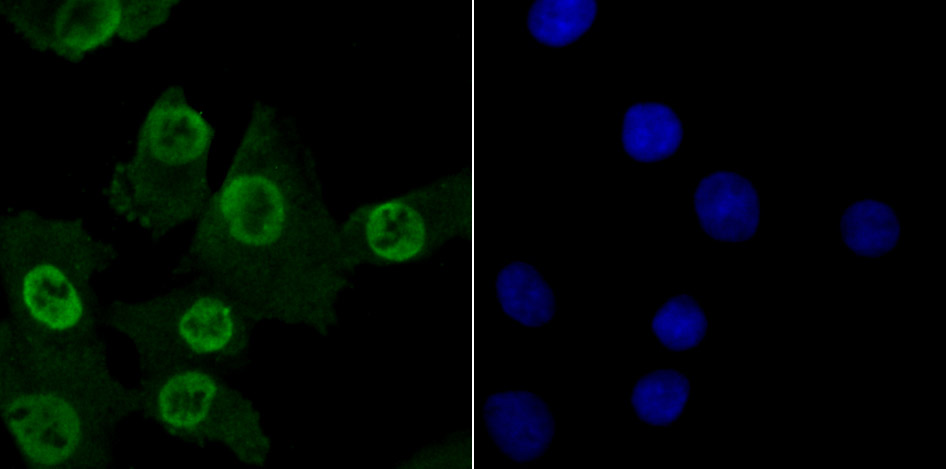 MBD3 Rabbit mAb