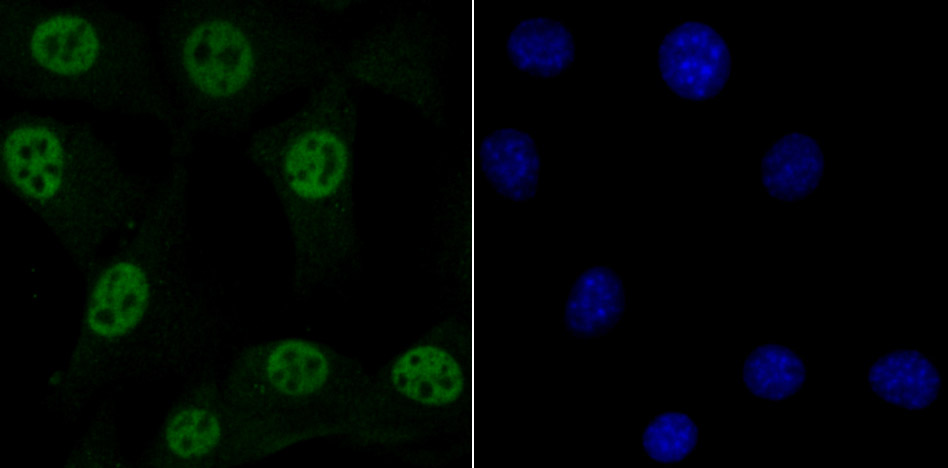 MBD3 Rabbit mAb