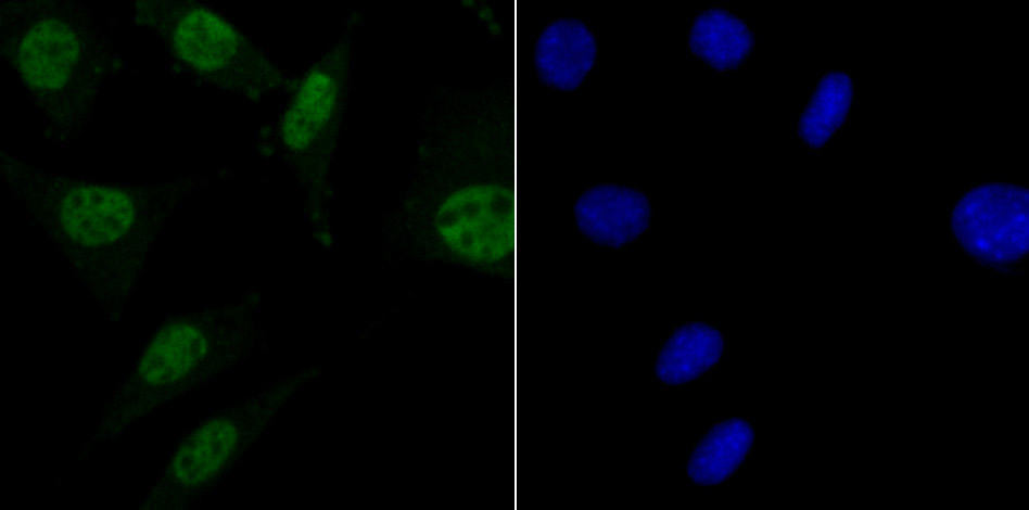 MBD3 Rabbit mAb