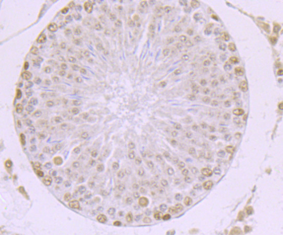 MBD3 Rabbit mAb