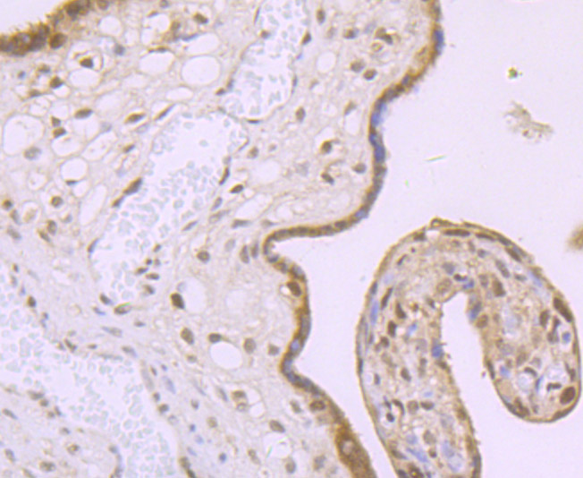 MBD3 Rabbit mAb