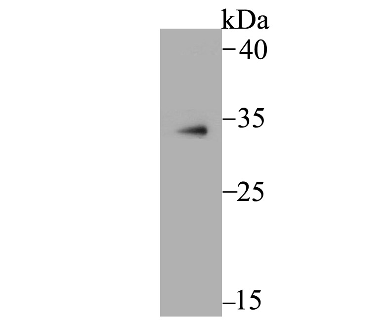 MBD3 Rabbit mAb