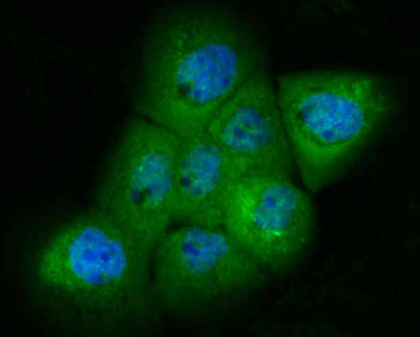 PAK2 Rabbit mAb