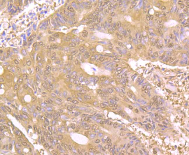 PAK2 Rabbit mAb