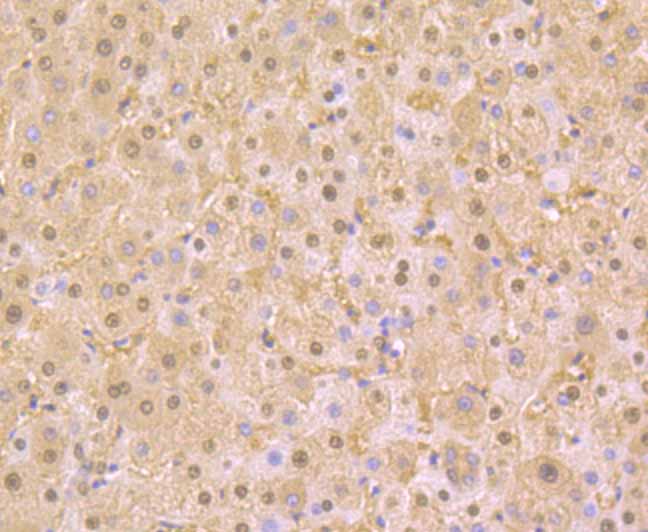 PAK2 Rabbit mAb