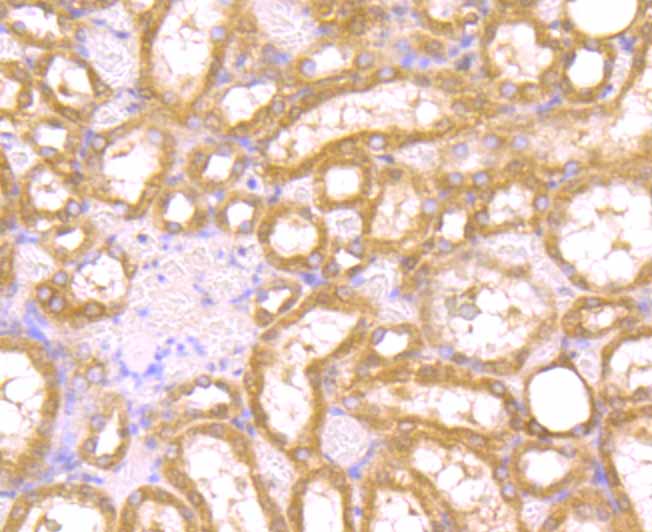 PAK2 Rabbit mAb