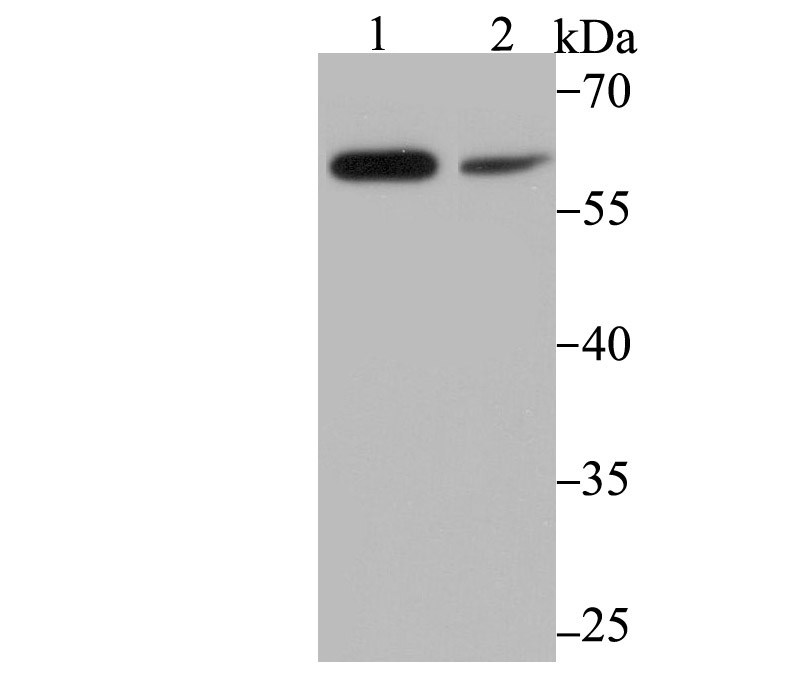 PAK2 Rabbit mAb