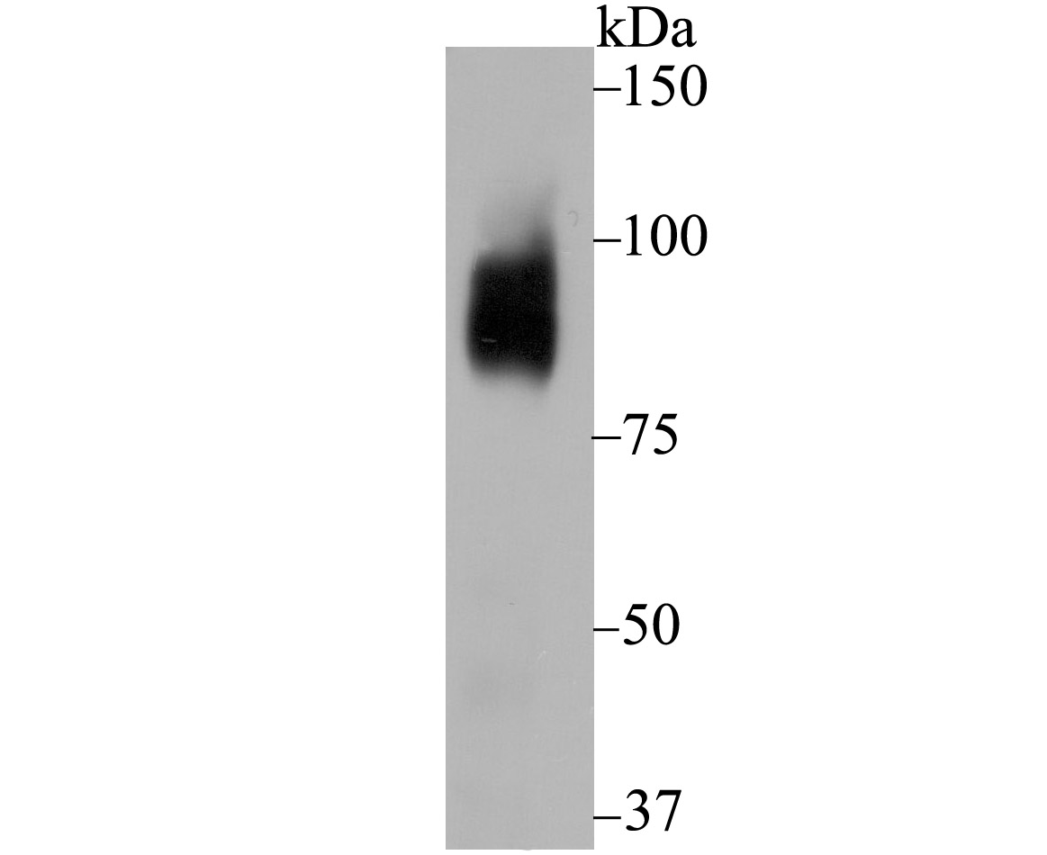 Bcl-6 Rabbit mAb