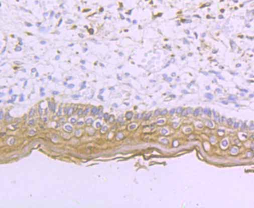 DSG1 Rabbit mAb