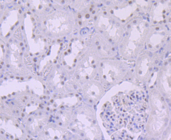 SNF5 Rabbit mAb