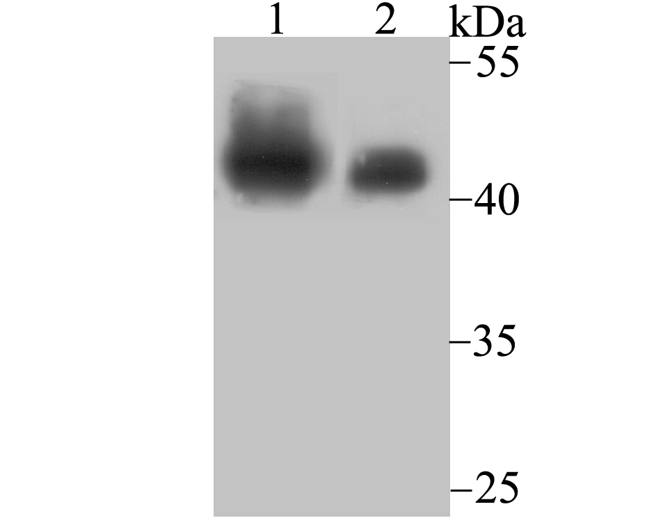 SNF5 Rabbit mAb