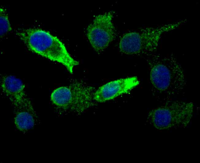 KDEL Rabbit mAb