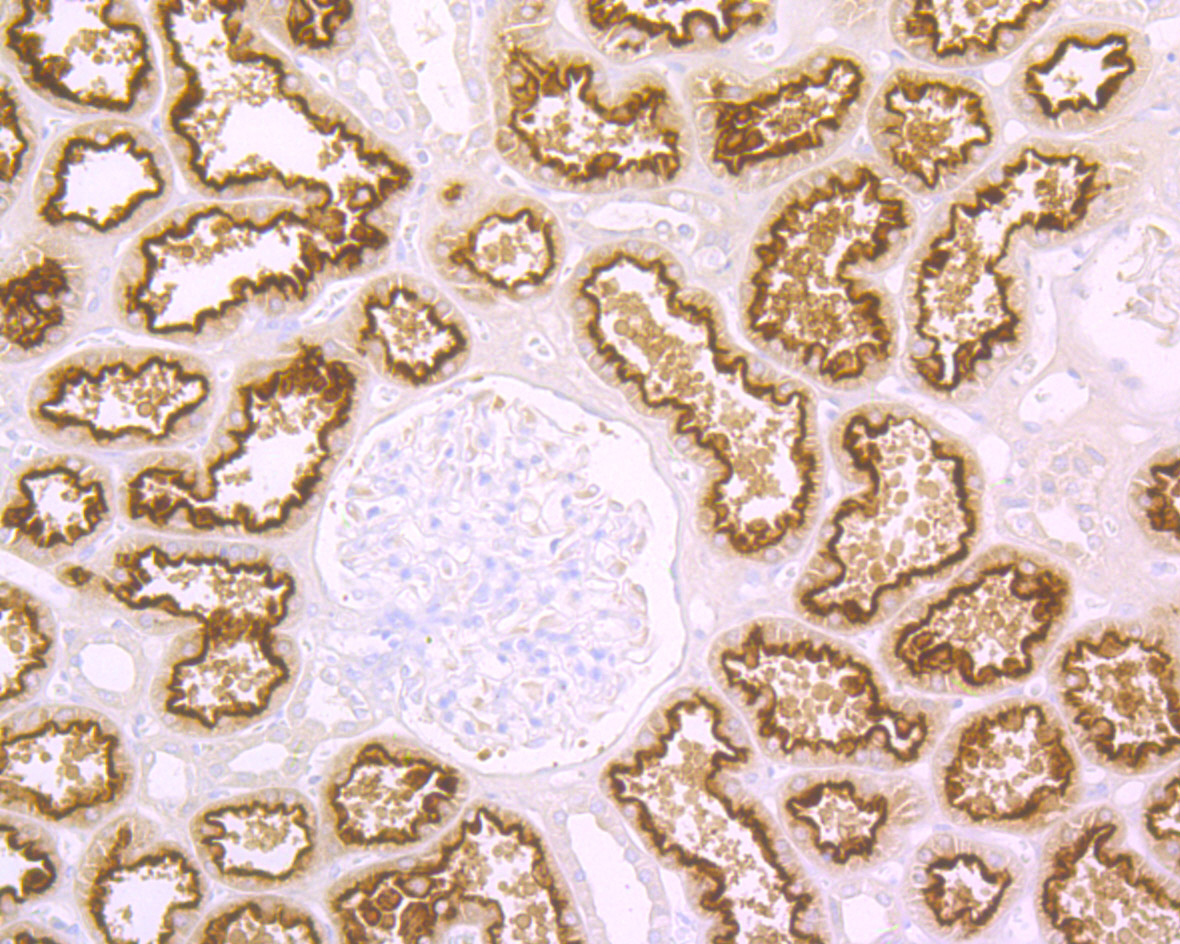 Cubilin Rabbit mAb