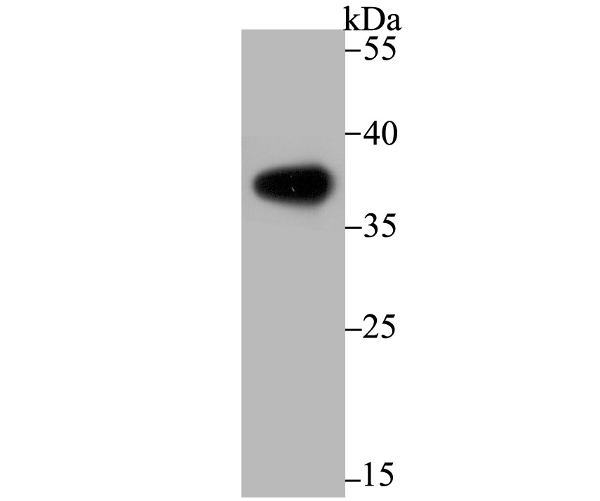 Liver Arginase Rabbit mAb