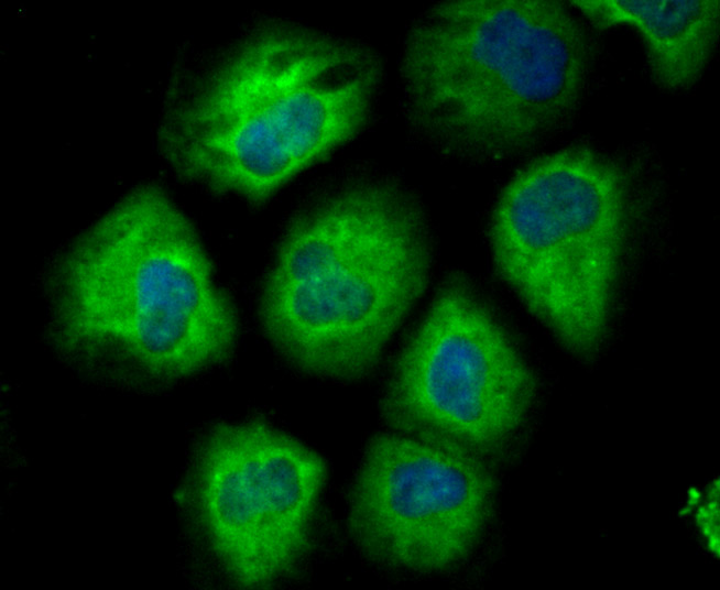 CD146 Rabbit mAb