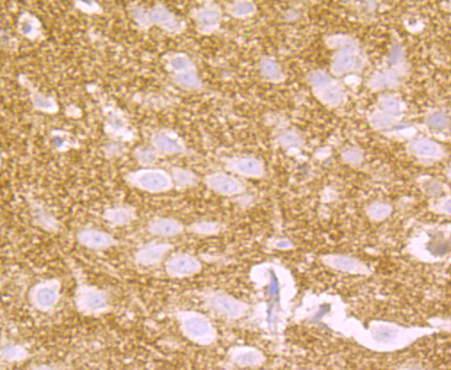 CD146 Rabbit mAb