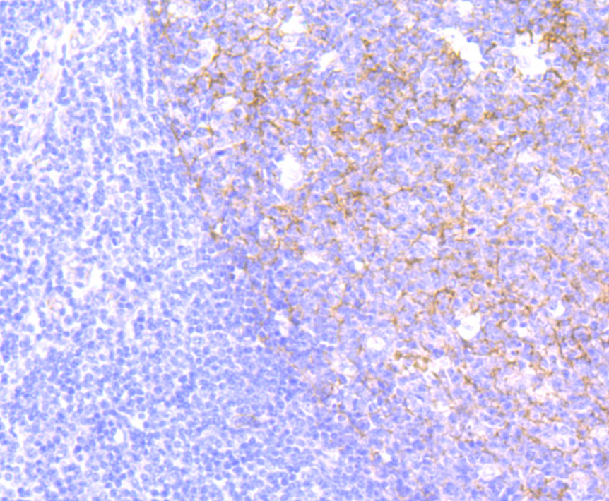 CD146 Rabbit mAb