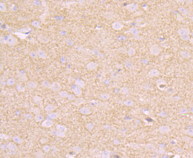 CD146 Rabbit mAb