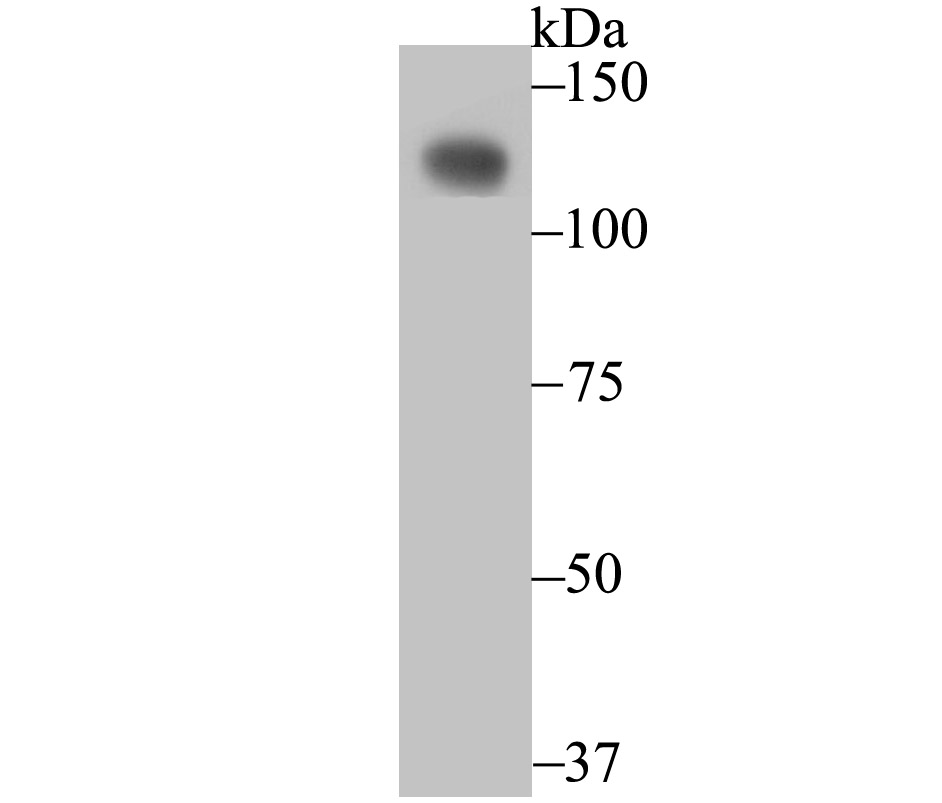 CD146 Rabbit mAb