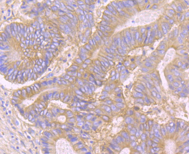 CD46 Rabbit mAb