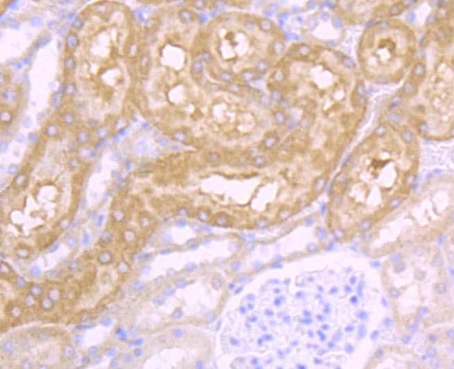 CD46 Rabbit mAb