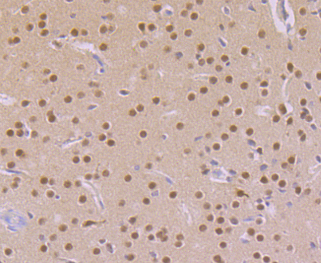 CAMKIV Rabbit mAb