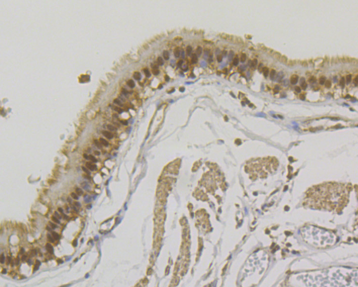 U1A Rabbit mAb