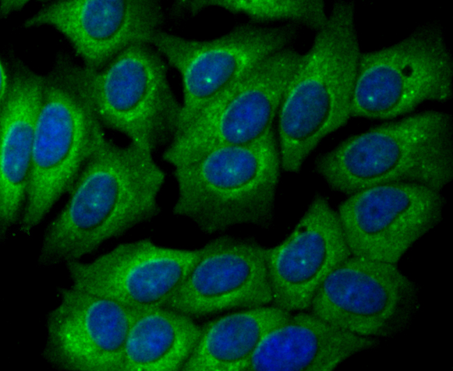 Glucose 6 phosphate isomerase Rabbit mAb